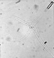 Myxobolus cerebralis, a myxosporean parasite, causes whirling disease in farmed salmon and trout and also in wild fish populations.